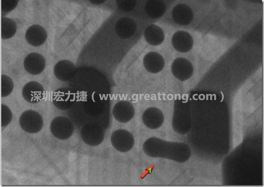 BGA因?yàn)楹笁|變小，造成錫膏過(guò)多而最終形成焊接短路的結(jié)果。